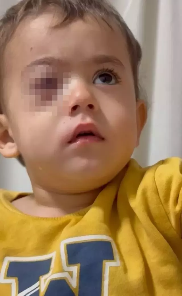 Torpil küçük çocuğun gözünü kör etti, babası kahreden gerçeği açıkladı