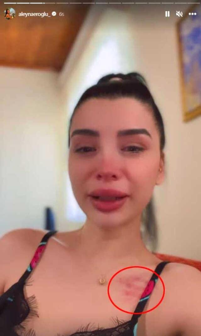 Fenomen yarışmacı Aleyna Eroğlu, futbolcu Batuhan Karadeniz'den şiddet gördüğünü iddia etti