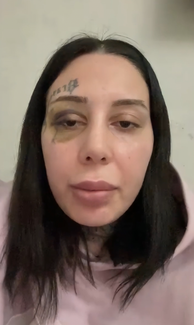 Eşini sokak ortasında öldüresiye döven kocadan akılalmaz ifade: Estetik yaptırıp boşanmak istedi