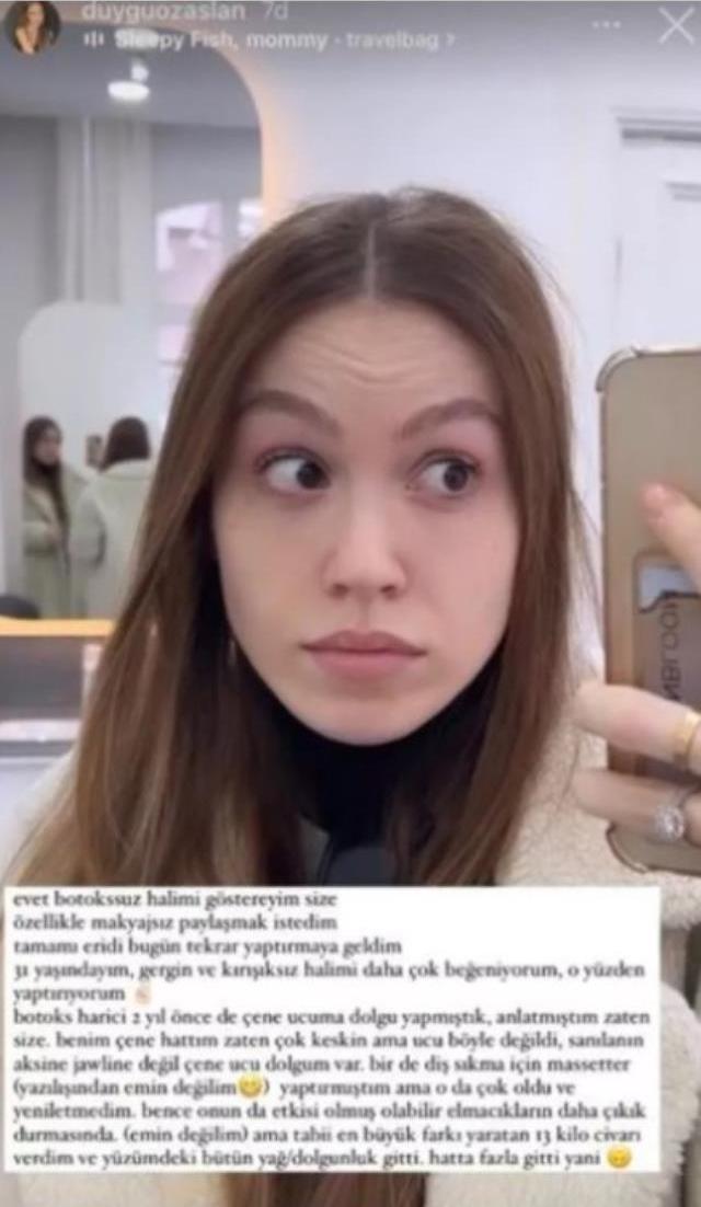 Yıllar önceki fotoğrafını paylaşan Duygu Özaslan, yüzüne yaptırdığı tüm estetikleri sıraladı