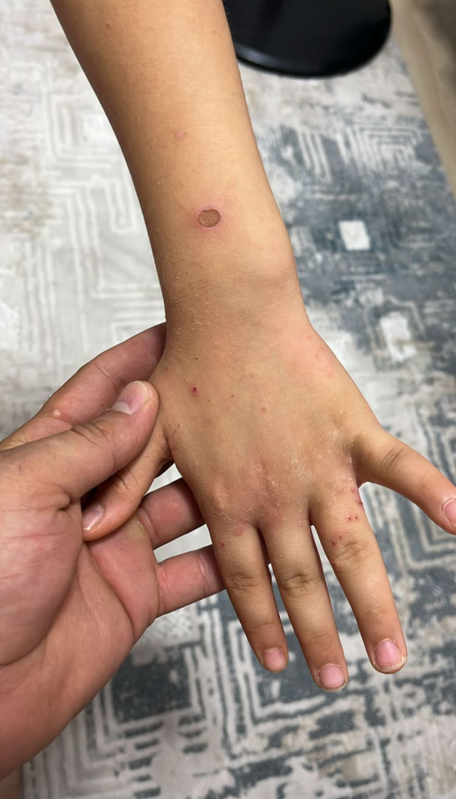 'Sular şehri' Kahramanmaraş'ta 20 gündür bir damla su akmıyor, hastalıklar başladı