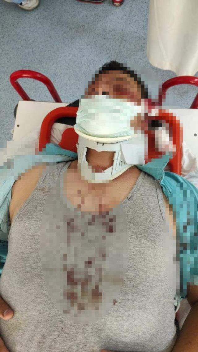 Lütfü Türkkan'ın kaçak villasının yıkımını görüntüleyen muhabir darbedildi