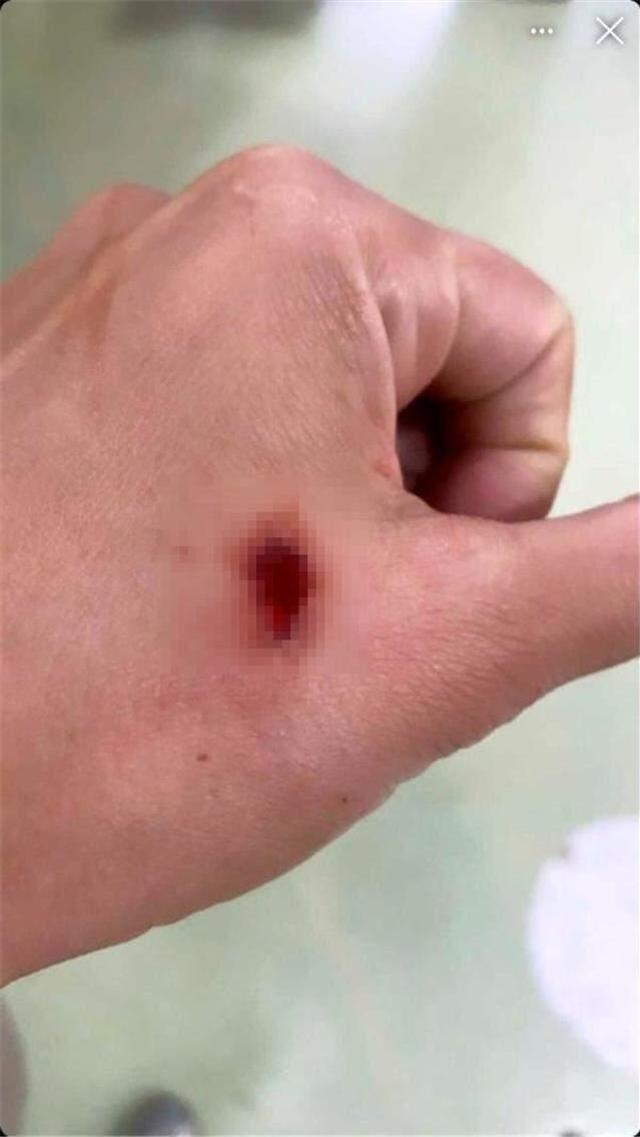 Eski Survivor yarışmacısı Duygu Bal, beslediği sokak köpeklerin saldırısına uğradı