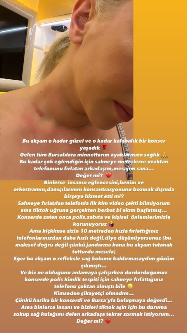 Ece Seçkin'e sahnedeyken telefon fırlatıldı! Boynunu paylaşıp isyan etti