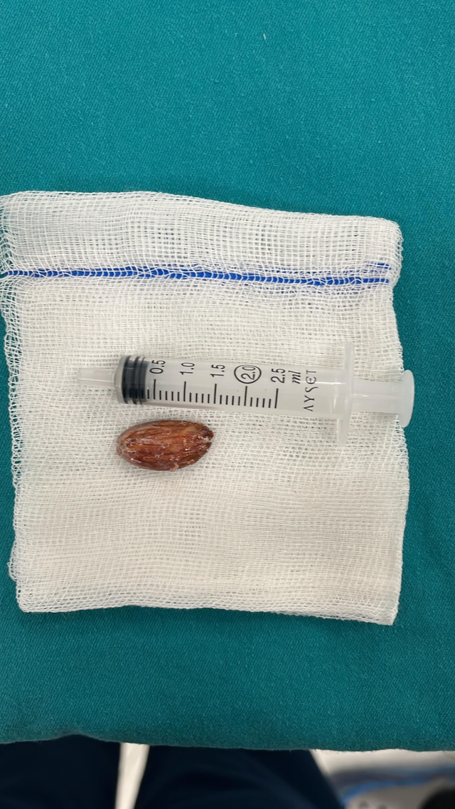 Küçük çocuğun masum davranışı, 16 günlük kardeşinin hayatına mal oluyordu