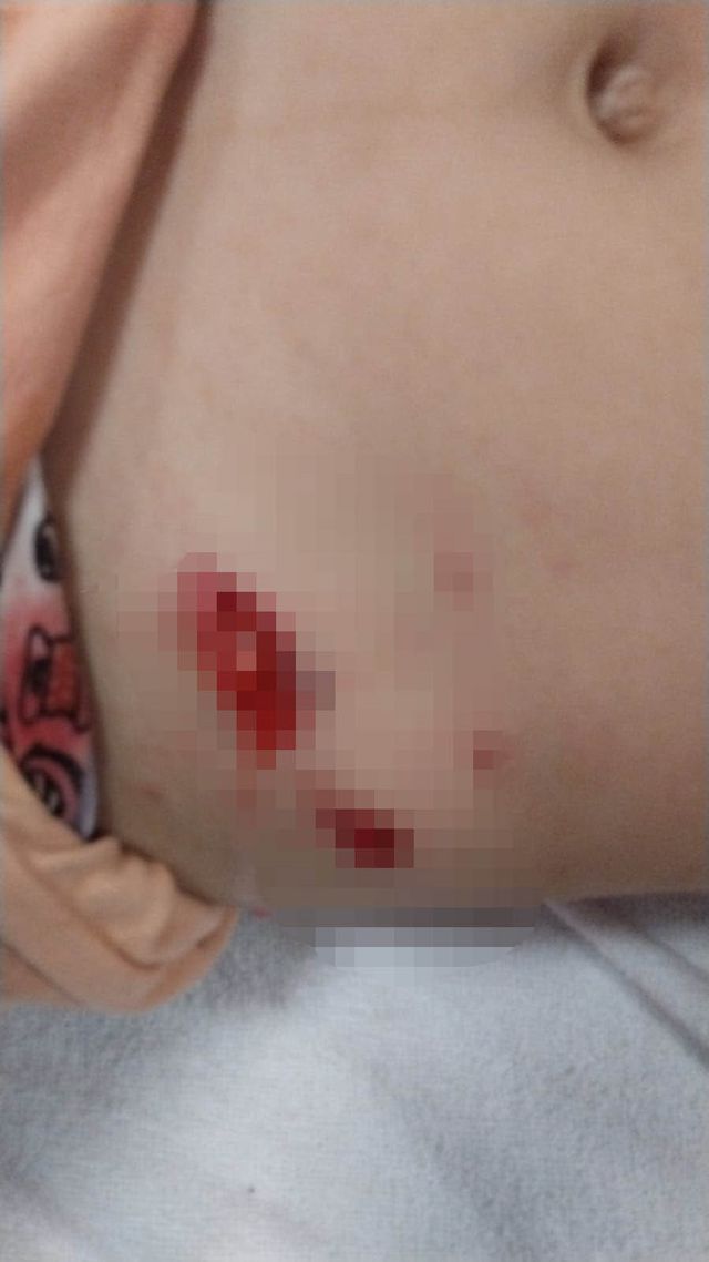 Ankara'da başıboş köpeklerin saldırısına uğrayan 5 yaşındaki çocuk hastanelik oldu