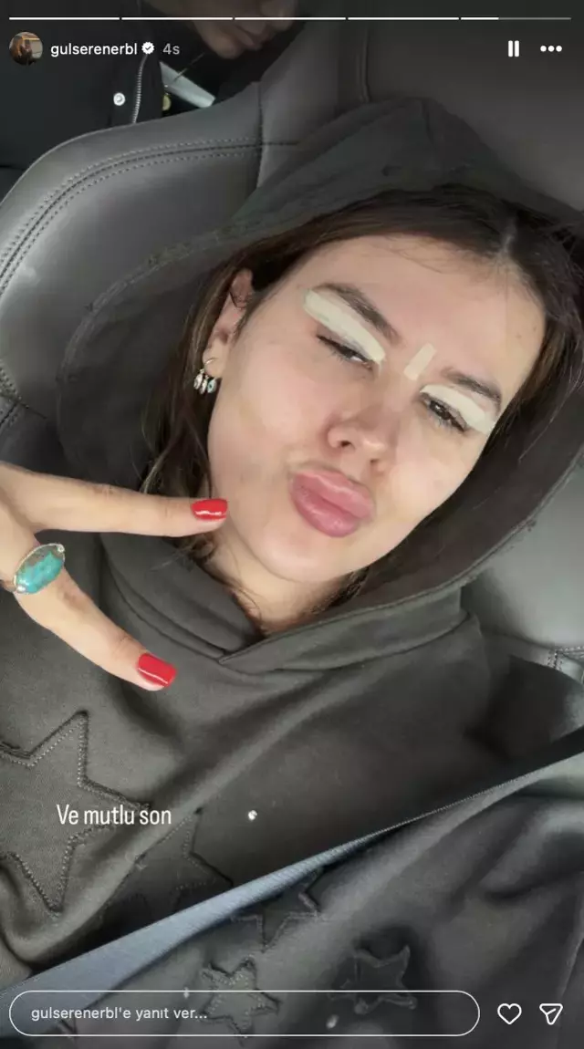 ازدواج گلسرن جیلان با محمد علی‌اربیل بسیار مورد بحث قرار گرفت! او جراحی پلک انجام داد