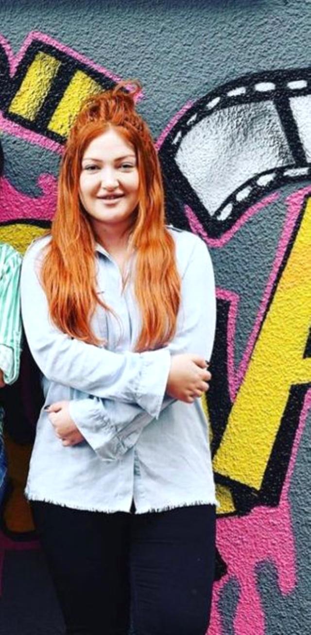 Danla Bilic eski hali - yeni hali! Danla Bilic ne ameliyatı oldu?