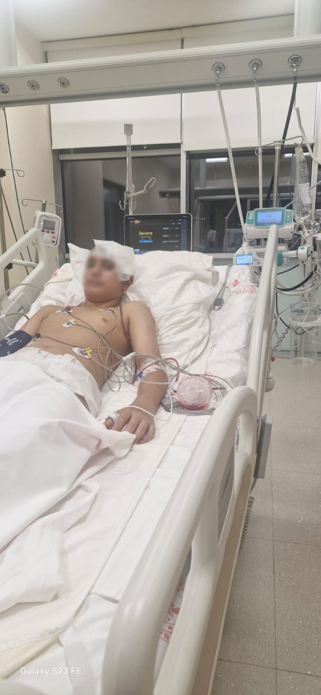 Akran zorbalığına maruz kalan 13 yaşındaki çocuğun kafatası titanyum parçalarıyla yeniden oluşturuldu