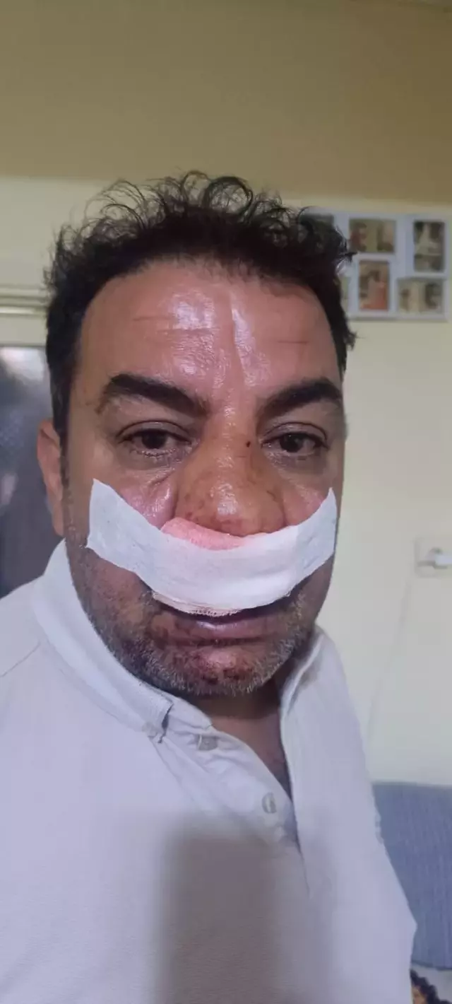 İzinsiz çekilen 4 fotoğrafa servet istediler, araya giren şoförün burnunu kırdılar
