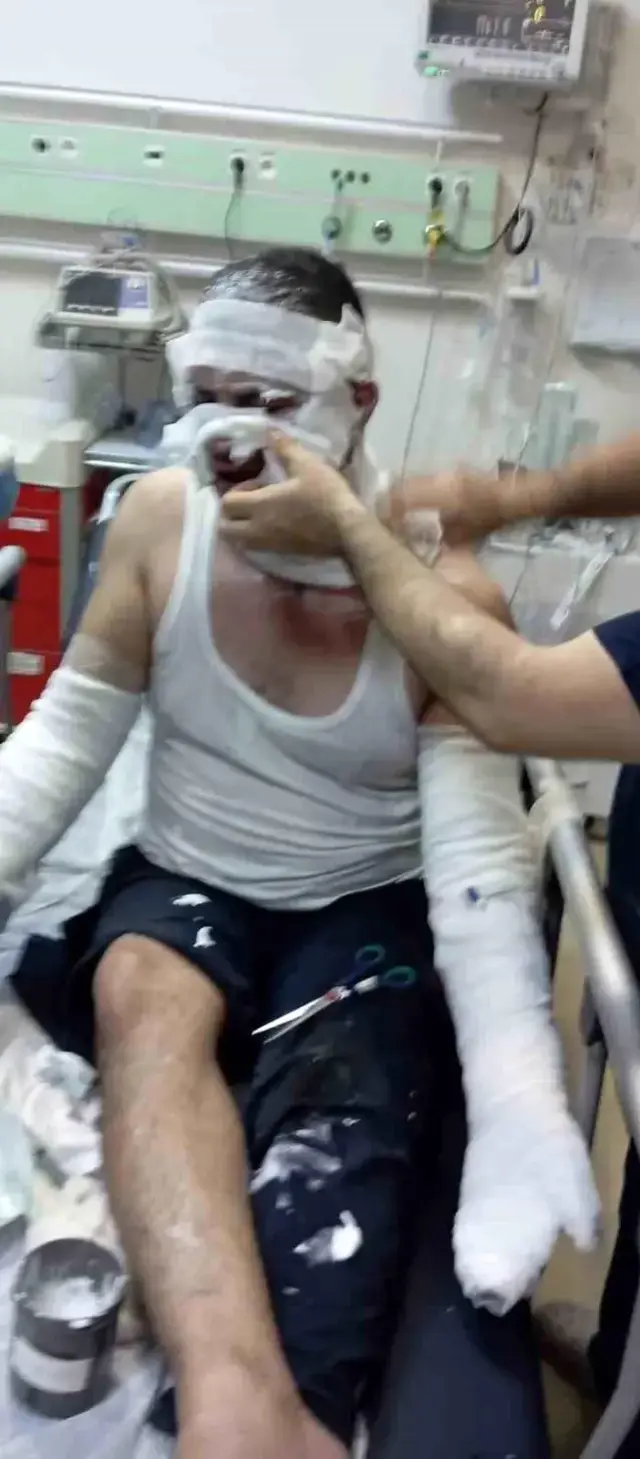 Alevlerin arasına düşen itfaiye eri ağır yaralandı