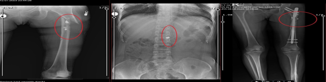Arkadaşını öldürdü, sevgilisini yaralayıp 21 gün cinsel saldırıda bulundu! İşte istenen ceza