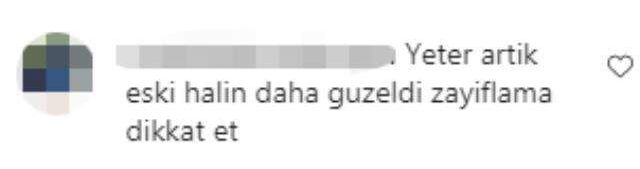 Yaşadığı rahatsızlıklarla gündeme gelen Seren Serengil'in son paylaşımında resmen kemikleri sayıldı