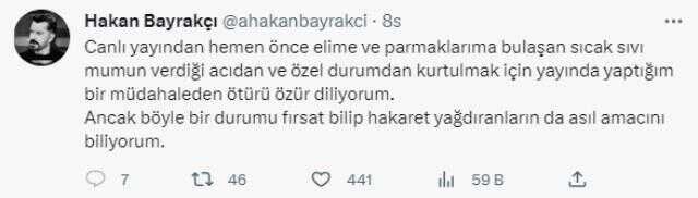 Ünlü anketçinin canlı yayında tırnaklarını kestiği görüntü büyük tepki çekti