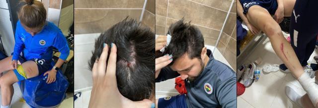 Büyük rezillik! Amed Spor'dan Fenerbahçe Kadın Futbol takımına saldırı