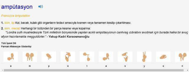 Ampute ne demek? TDK'ya göre ampüte anlamı var mı, nedir? Ampütasyon ne demek? Ampüte nedir, ne anlama geliyor?