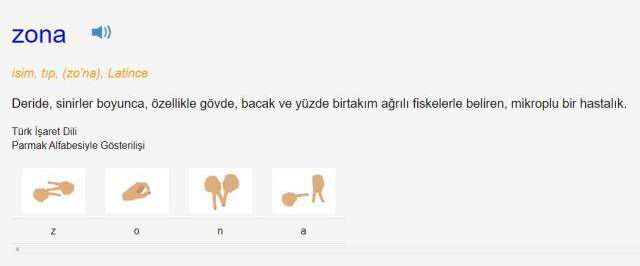 Zona bulaşıcı mı? Zona nedir, ne demek? Zona hastalığı bulaşıcı mıdır? Zona bulaşır mı? Zona belirtileri nelerdir?