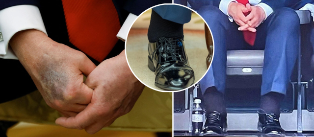 Doktoru Trump'ın kalp yaşını açıkladı