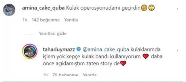 Estetikle bambaşka birine dönüşen Taha Duymaz'dan takipçisine 'kepçe kulak' cevabı