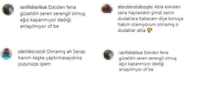 Canlı yayında konuşmakta zorlanan Serap Paköz, 'Estetikten konuşamıyor' iddiasına sert çıkıştı