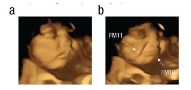 Hamile kadına lahana yedirildi, sonra da karnındaki bebek görüntülendi! Sonuç ilginç