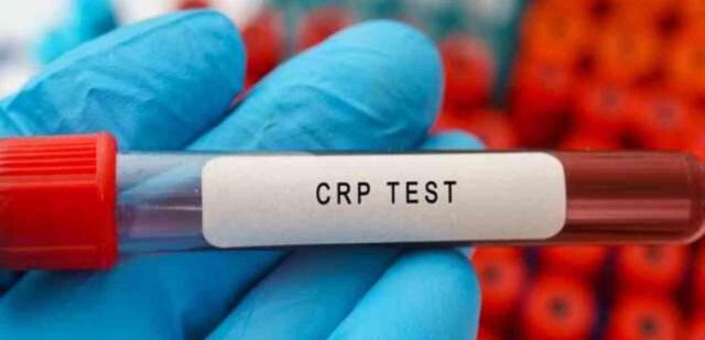 CRP NEDEN YÜKSELİR? CRP nedir, normal değeri kaç?