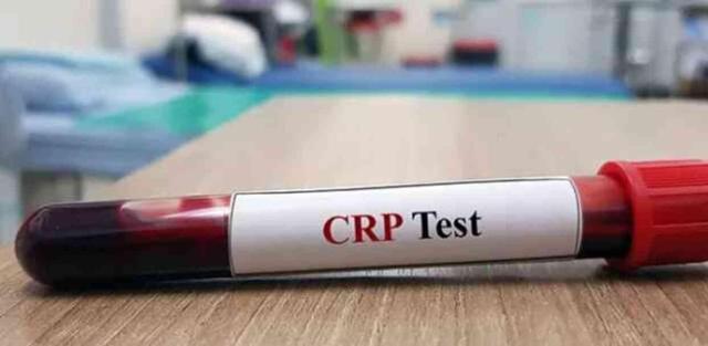 CRP NEDEN YÜKSELİR? CRP nedir, normal değeri kaç?