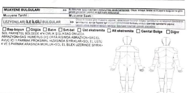 ABB çalışanının eşinden darp iddiası: Kocam beni dövdü, belediye görevlileriyle gelip tehdit etti