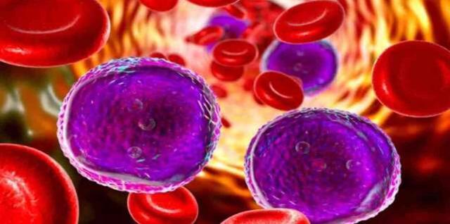 Talasemi nedir? Talasemi hastalığı tedavisi nedir?