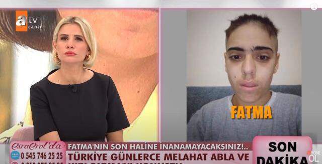 İkinci kez ailesinin evinden kaçtıktan sonra saçlarını kazıtan Fatma'nın son hali Esra Erol'u yıktı