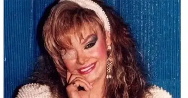 Selçuk Ural'dan çok konuşulacak Bergen çıkışı: Yüzüne kezzap atılmasaydı filmi yapılmazdı