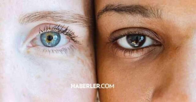 Göz çapaklanması neden olur? Göz Çapaklanması neyin belirtisi?