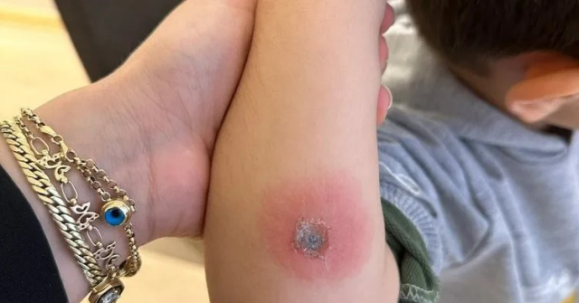 Gaziantep'te yurttaki çocuklara işkence iddiası: 1 kişi gözaltında