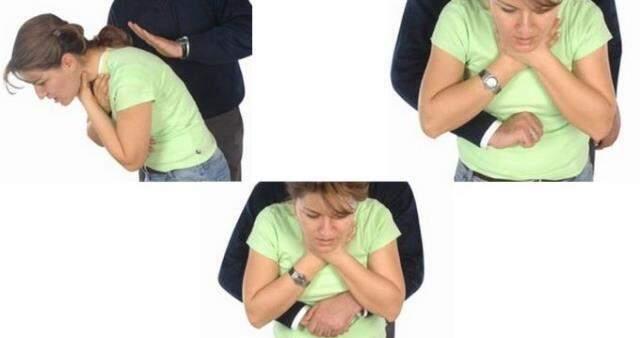 Heimlich Manevrası nedir? Heimlich Manevrası nasıl uygulanır?