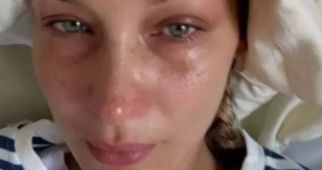 Lyme Hastalığıyla Mücadelede Bella Hadid: Sağlık Serüveni ve Kariyeri