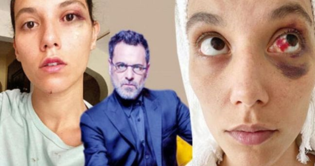 Deniz Bulutsuz kimdir? Ozan Güven'in eski sevgilisi Deniz Bulutsuz kaç yaşında, nereli, ne iş yapıyor?