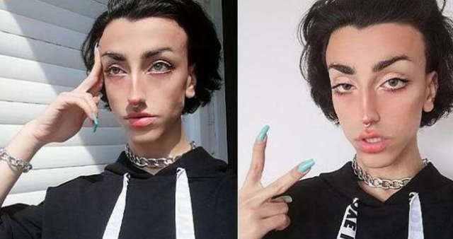 Mika Raun eski hali nasıl? Mika Raun'un eski cinsiyeti nedir, eski adı nedir?