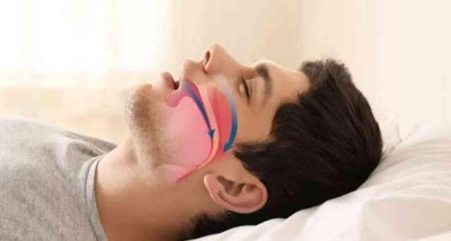 UYKU APNESİNE HANGİ BÖLÜM BAKIYOR? Uyku apnesi nedir, belirtileri neler?