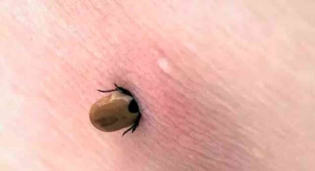 Kırım Kongo Kanamalı Ateşi (KKKA) belirtileri ne? KKKA nasıl bulaşır, nasıl önlenir, ne yapılmalı?