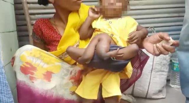 Hastanede tutulan örümcek bebek, görenleri hayrete düşürdü! İki eli ve toplamda 6 bacağı var