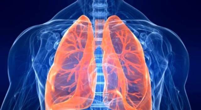 Akciğer kanseri belirtileri nelerdir? Akciğer kanseri ilk evre belirtileri! Akciğer kanseri 4 evre ölüm belirtileri nedir?
