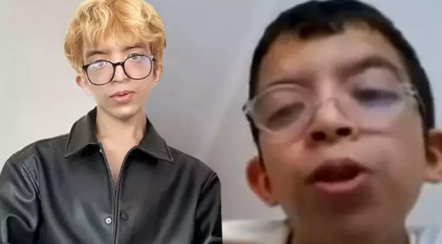 Zorbalığa daha fazla dayanamayan 'Tablet Reis' 5 ayrı yüz ameliyatı oldu