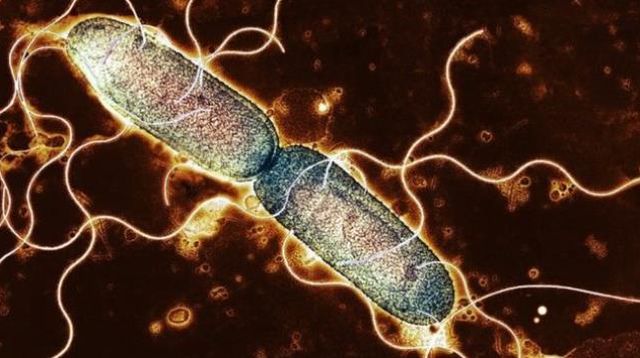 Salmonella bakterisi nedir, nasıl bulaşır? Salmonella neden olur?