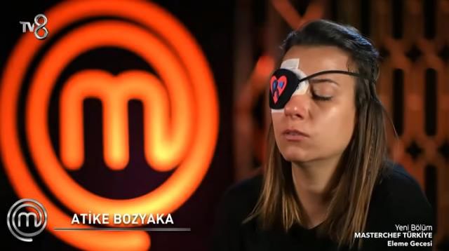 Masterchef Atike'nin gözüne ne oldu? Atike'nin hastalığı nedir? Masterchef Atike'nin sağ gözünde neden bant var? Atike'nin sağlık durumu nasıl?