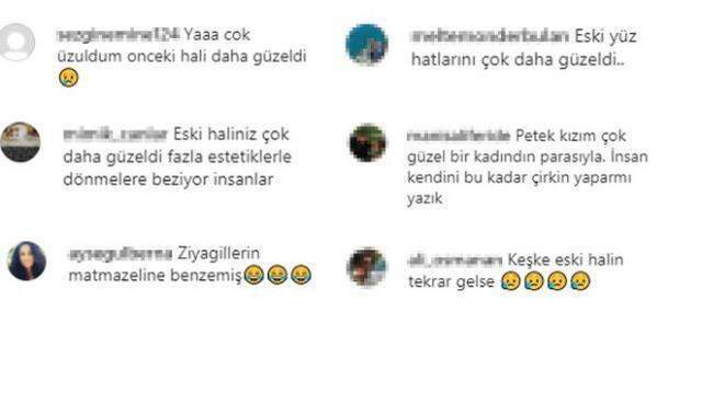 Estetiğin dozunu kaçıran Petek Dinçöz, bambaşka birine döndü