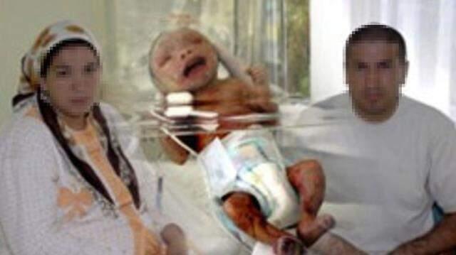 Bir dönem tüm Türkiye onu konuşuyordu! İşte herkesten saklanan yılan bebeğin akıbeti