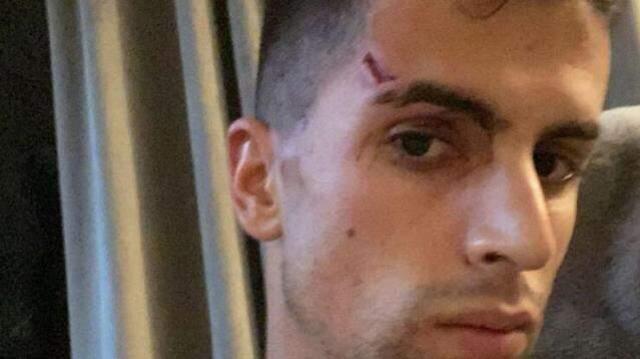 Manchester City'nin yıldızı Joao Cancelo, evine giren 4 hırsızın saldırısına uğradı