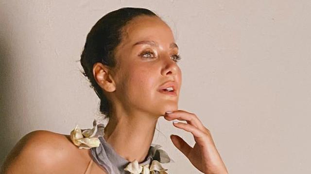 İrem Helvacıoğlu burun estetiği yaptırdı! Son halini beğenen de var beğenmeyen de