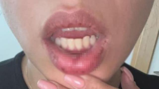 Taksici şiddeti son bulmuyor! Azerbaycanlı şarkıcının kafasını demir bariyerlere çarpıp, burnunu kırdı