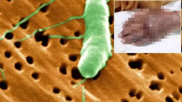 Kış aylarının yeni korkulu rüyası! Selden sonra ortaya çıkıyor, kol bacak ne varsa yok ediyor